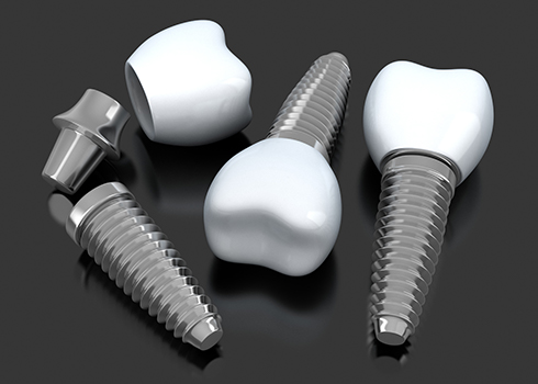 Three implant supported dental crowns