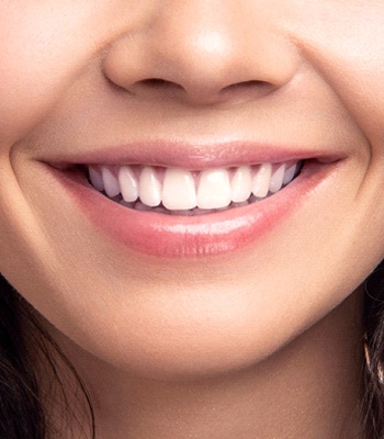 close-up of healthy smile